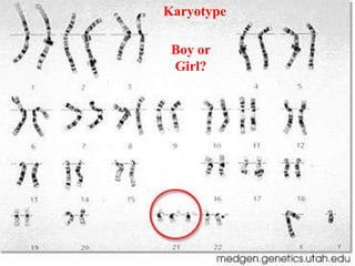 Karyotype Boy or Girl? 