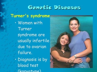 Genetic Diseases Turner's syndrome Women with Turner syndrome are usually infertile due to ovarian failure.  Diagnosis is by blood test (karyotype).   
