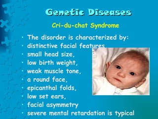 Genetic Diseases Cri-du-chat Syndrome  The disorder is characterized by: distinctive facial features,  small head size, low birth weight,  weak muscle tone,  a round face,  epicanthal folds, low set ears,  facial asymmetry severe mental retardation is typical   