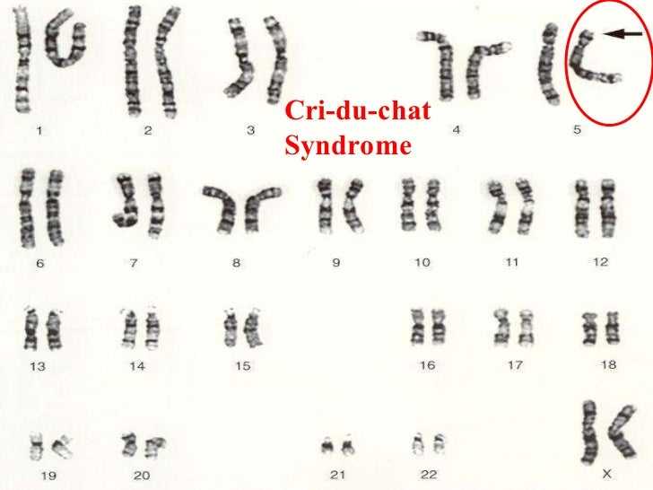 Cri Du Chat Pedigree Chart