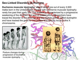 Sex-Linked Disorders in Humans
Duchenne muscular dystrophy, affects about one out of every 3,500
males born in the United States. People with Duchenne muscular dystrophy
rarely live past their early 20s. The disease is characterized by a progressive
weakening of the muscles and loss of coordination. Researchers have
traced the disorder to the absence of a key muscle protein called dystrophin
and have tracked the gene for this protein to a specific locus on the X
chromosome.
Posture changes during
progression of Duchenne
muscular dystrophy.
 