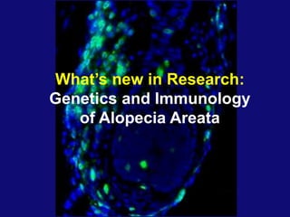 What’s new in Research:
Genetics and Immunology
of Alopecia Areata
 