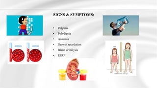 Polyuria Signs GENETICS and KIDNEY DISEASES / | PPTX