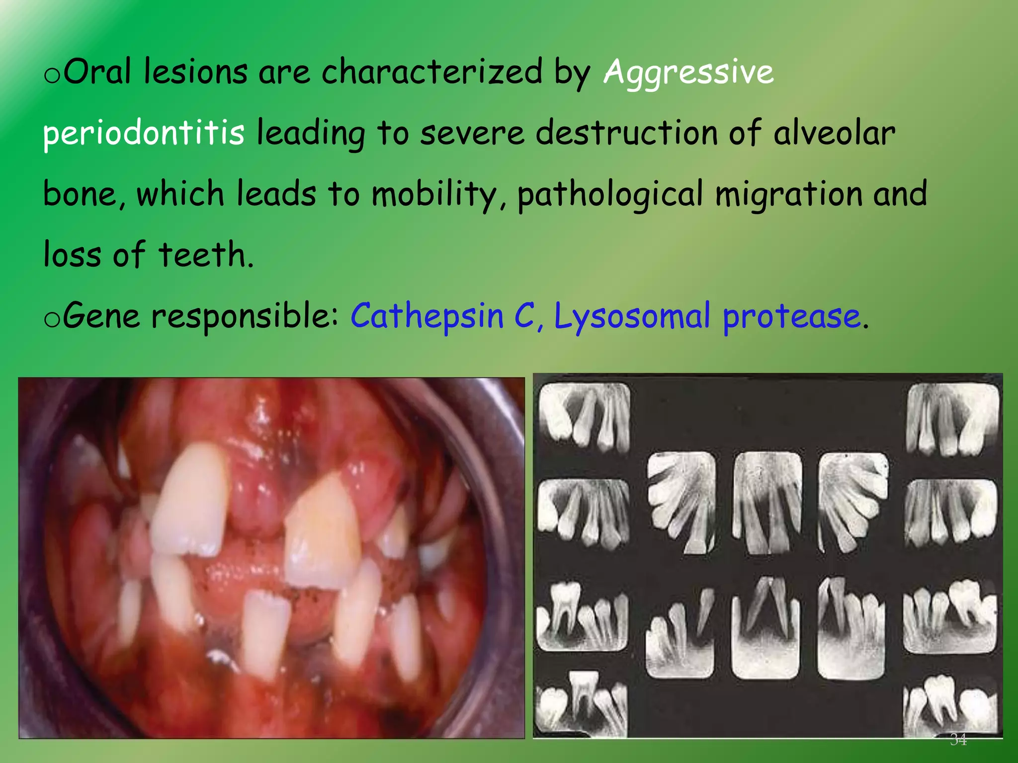 GENETICS AND PERIODONTAL DISEASES | PPT