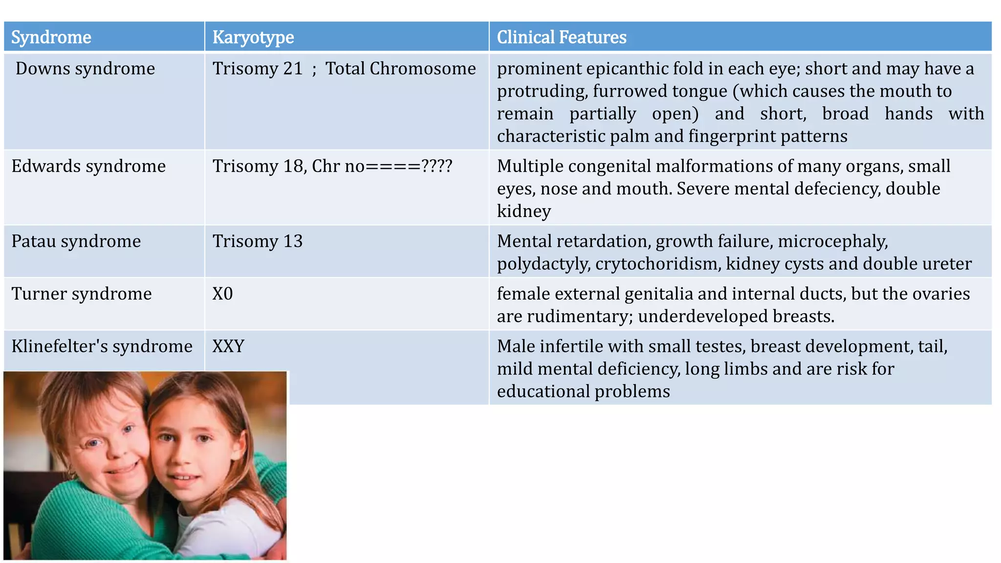 Syndrome Karyotype Clinical Features
Downs syndrome Trisomy 21 ; Total Chromosome prominent epicanthic fold in each eye; short and may have a
protruding, furrowed tongue (which causes the mouth to
remain partially open) and short, broad hands with
characteristic palm and fingerprint patterns
Edwards syndrome Trisomy 18, Chr no====???? Multiple congenital malformations of many organs, small
eyes, nose and mouth. Severe mental defeciency, double
kidney
Patau syndrome Trisomy 13 Mental retardation, growth failure, microcephaly,
polydactyly, crytochoridism, kidney cysts and double ureter
Turner syndrome X0 female external genitalia and internal ducts, but the ovaries
are rudimentary; underdeveloped breasts.
Klinefelter's syndrome XXY Male infertile with small testes, breast development, tail,
mild mental deficiency, long limbs and are risk for
educational problems
 
