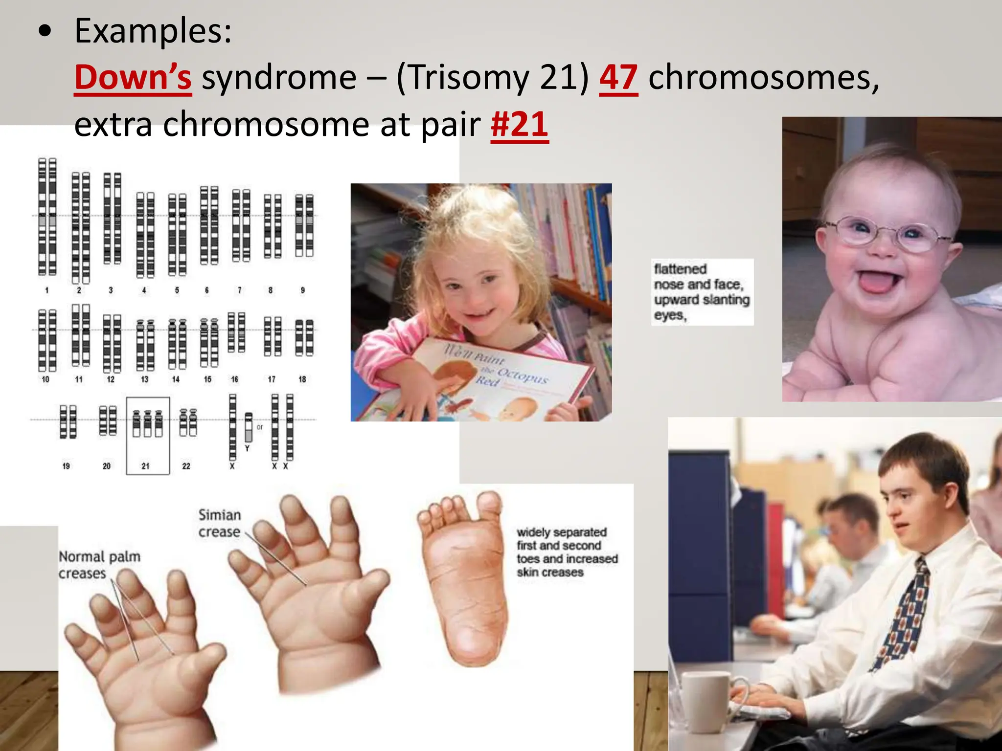 • Examples:
Down’s syndrome – (Trisomy 21) 47 chromosomes,
extra chromosome at pair #21
 