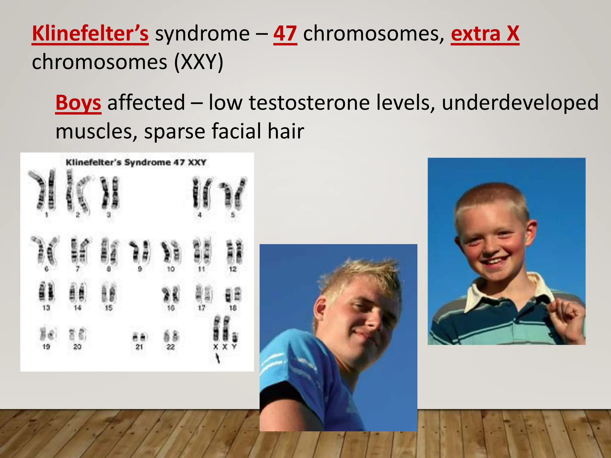 Klinefelter’s syndrome – 47 chromosomes, extra X
chromosomes (XXY)
Boys affected – low testosterone levels, underdeveloped
muscles, sparse facial hair
 