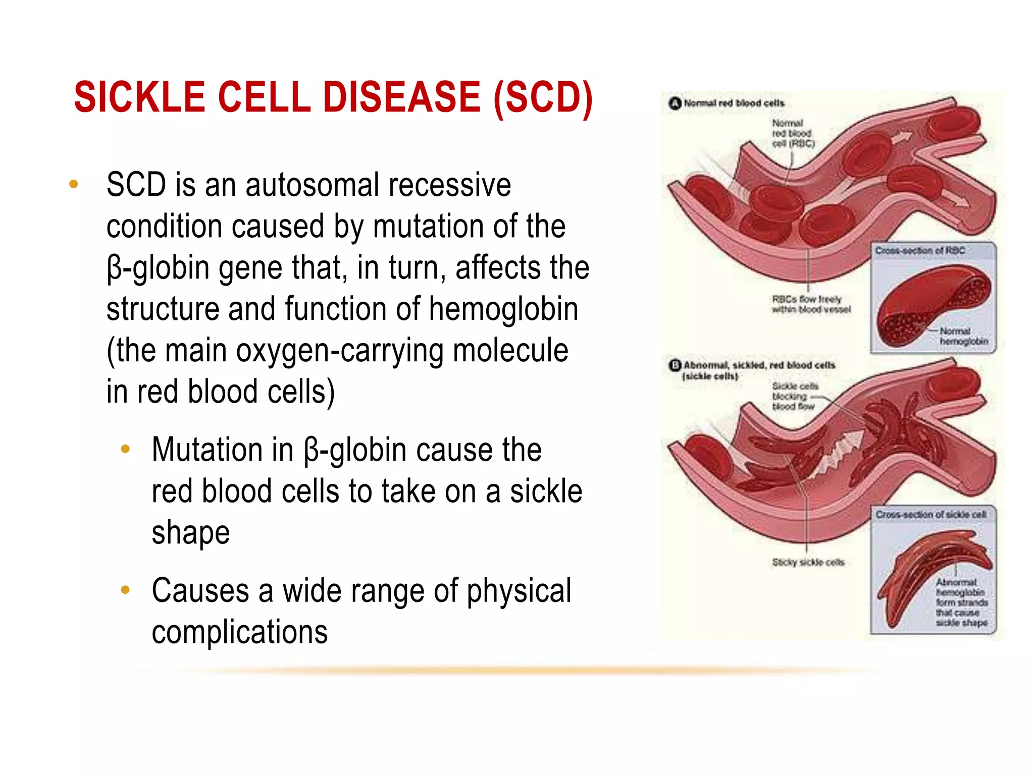 SICKLE CELL DISEASE (SCD)
• SCD is an autosomal recessive
condition caused by mutation of the
β-globin gene that, in turn, affects the
structure and function of hemoglobin
(the main oxygen-carrying molecule
in red blood cells)
• Mutation in β-globin cause the
red blood cells to take on a sickle
shape
• Causes a wide range of physical
complications

 