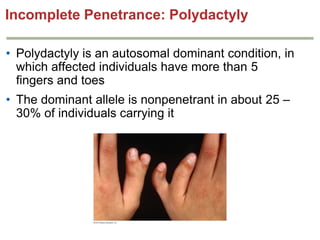 Incomplete Penetrance: Polydactyly
• Polydactyly is an autosomal dominant condition, in
which affected individuals have more than 5
fingers and toes
• The dominant allele is nonpenetrant in about 25 –
30% of individuals carrying it

 