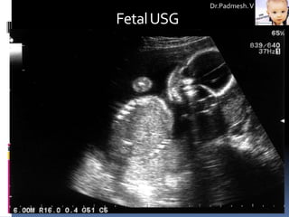 Dr.Padmesh. V

Fetal USG
 
