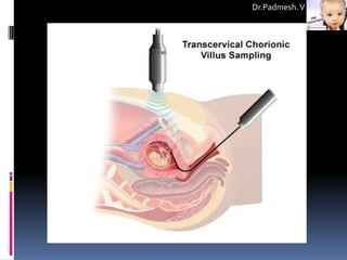 Dr.Padmesh. V
 