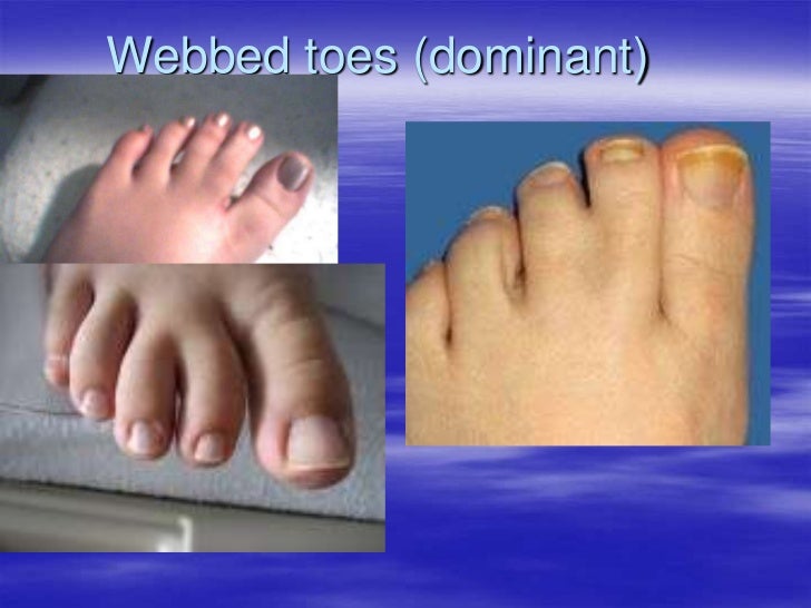 Genetics Examples genetics-examples