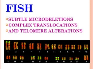FISH
 SUBTLE MICRODELETIONS
 COMPLEX TRANSLOCATIONS
 AND TELOMERE ALTERATIONS
 
