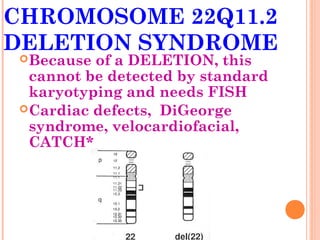CHROMOSOME 22Q11.2
DELETION SYNDROME
  Because of a DELETION, this
   cannot be detected by standard
   karyotyping and needs FISH
  Cardiac defects, DiGeorge
   syndrome, velocardiofacial,
   CATCH*
 
