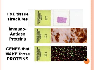 H&E tissue
structures

 Immuno-
  Antigen
 Proteins

GENES that
MAKE those
PROTEINS
 