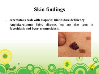 Skin findings
- eczematous rash with alopecia: biotinidase deficiency
- Angiokeratoma: Fabry disease, but are also seen in
fucosidosis and beta- mannosidosis.
12/9/2022 42
 