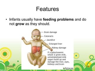 Features
• Infants usually have feeding problems and do
not grow as they should.
12/9/2022 49
 