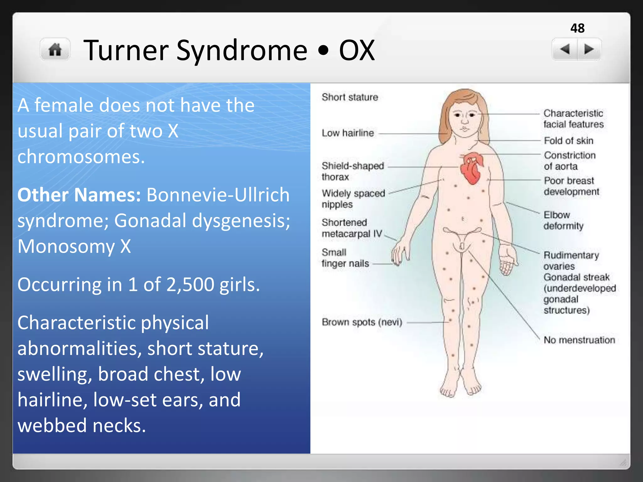 Klinefelter Syndrome • XXY
 47, XXY, or XXY syndrome is a condition in which males
have an extra X sex chromosome.
 While females have an XX chromosomal makeup, and
males an XY, affected individuals have at least two X
chromosomes and at least one Y chromosome.
 1 out of every 1,000 males.
 One in every 500 males have an extra X chromosome
but do not have the syndrome.
 The syndrome can affect different stages of physical,
language and social development. The most common
symptom is infertility. Because they often don't make as
much of the male hormone testosterone as other boys,
teenagers with Klinefelter's syndrome may have less
facial and body hair and may be less muscular than
other boys.
 They may have trouble using language to express
themselves. They may be shy and have trouble fitting
in.
48
 
