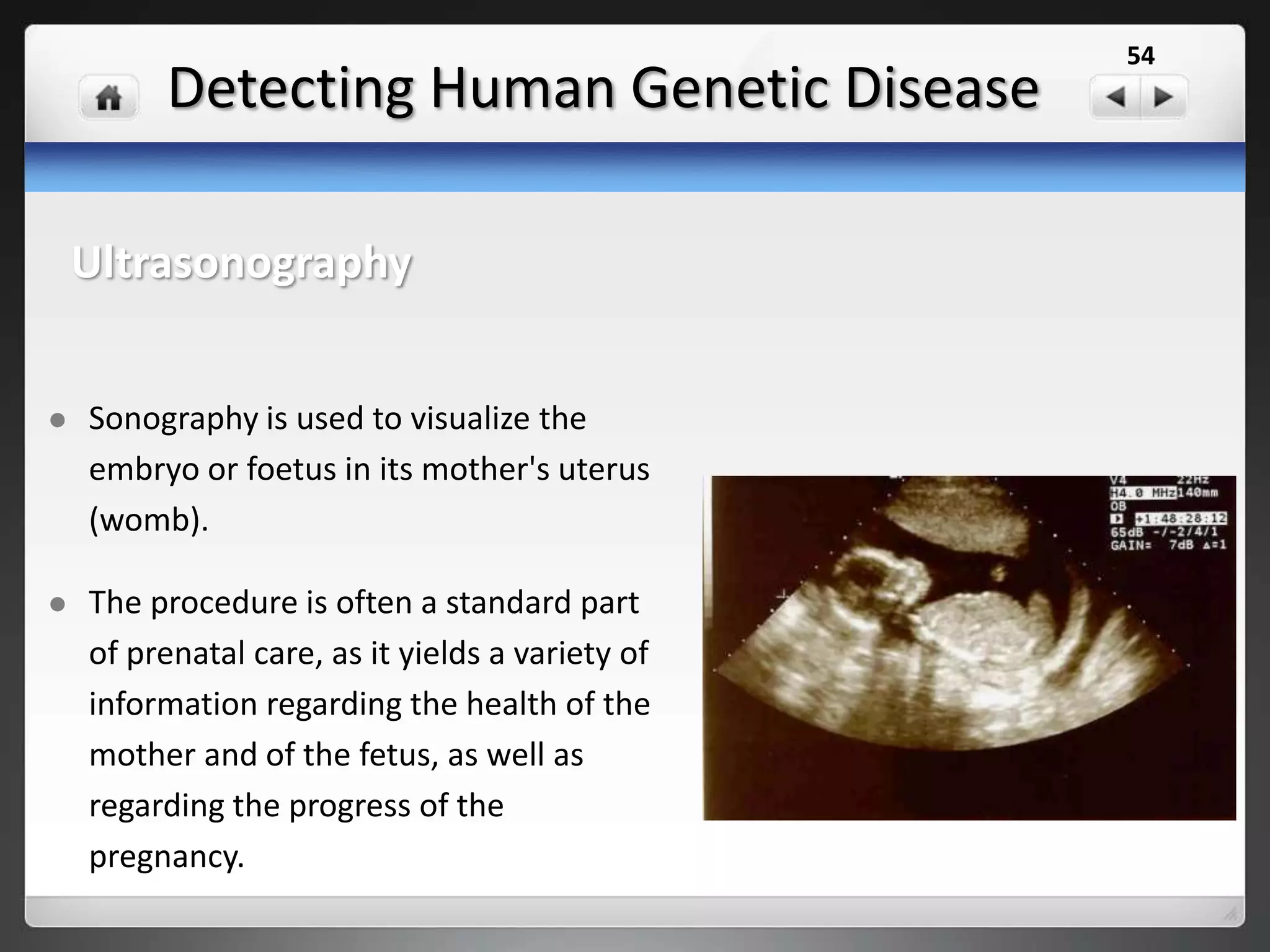 Detecting Human Genetic Disease
Examines the nucleotides at specific
locations on a person's DNA for genetic
purposes.
Carrier testing is used to identify people
who carry one copy of a gene mutation
that, when present in two copies, can
cause a genetic disorder.
This type of testing is for individuals who
have a family history of a genetic disorder
and to people in ethnic groups with an
increased risk of specific genetic
conditions.
Having both parents tested can provide
information about a couple's risk of having
a child with a genetic condition.
Immune System
 Lupus
 Graves' disease
 Celiac disease
 Multiple sclerosis
Psoriasis
Cardiovascular Conditions
 Aneurysm
 Atrial fibrillation
 Heart disease
 Peripheral arterial disease
Venous thromboembolism
Aging
 Macular degeneration
 Alzheimer's disease
 Osteoarthritis
 Rheumatoid arthritis
General Health
 Obesity
 Migraine
 Type 1 diabetes
Type 2 diabetes
Cancers
 Bladder cancer
 Breast cancer
 Colorectal cancer
 Gastric cancer
 Lung cancer
 Prostate cancer
 Skin cancer
DNA testing
54
 