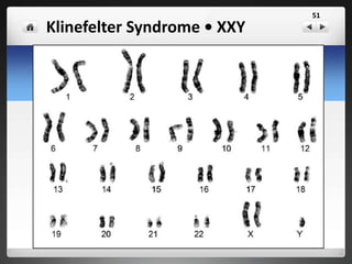 Detecting Human Genetic Disease
 Is a medical procedure used in prenatal
diagnosis of chromosomal abnormalities
and fetal infections
 A small amount of amniotic fluid, which
contains fetal tissues, is extracted from the
amnion or amniotic sac surrounding a
developing fetus
 The fetal DNA is examined for genetic
abnormalities.
Amniocentesis (amniotic fluid test or AFT)
51
 
