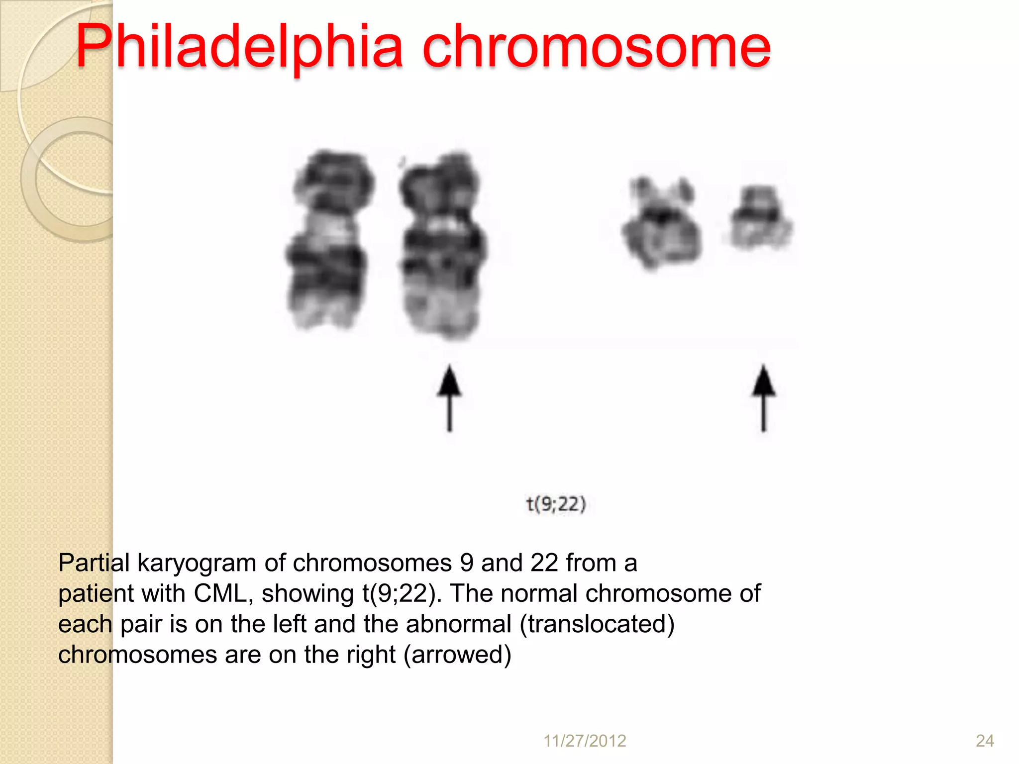 Philadelphia chromosome




Partial karyogram of chromosomes 9 and 22 from a
patient with CML, showing t(9;22). The normal chromosome of
each pair is on the left and the abnormal (translocated)
chromosomes are on the right (arrowed)


                                        11/27/2012            24
 