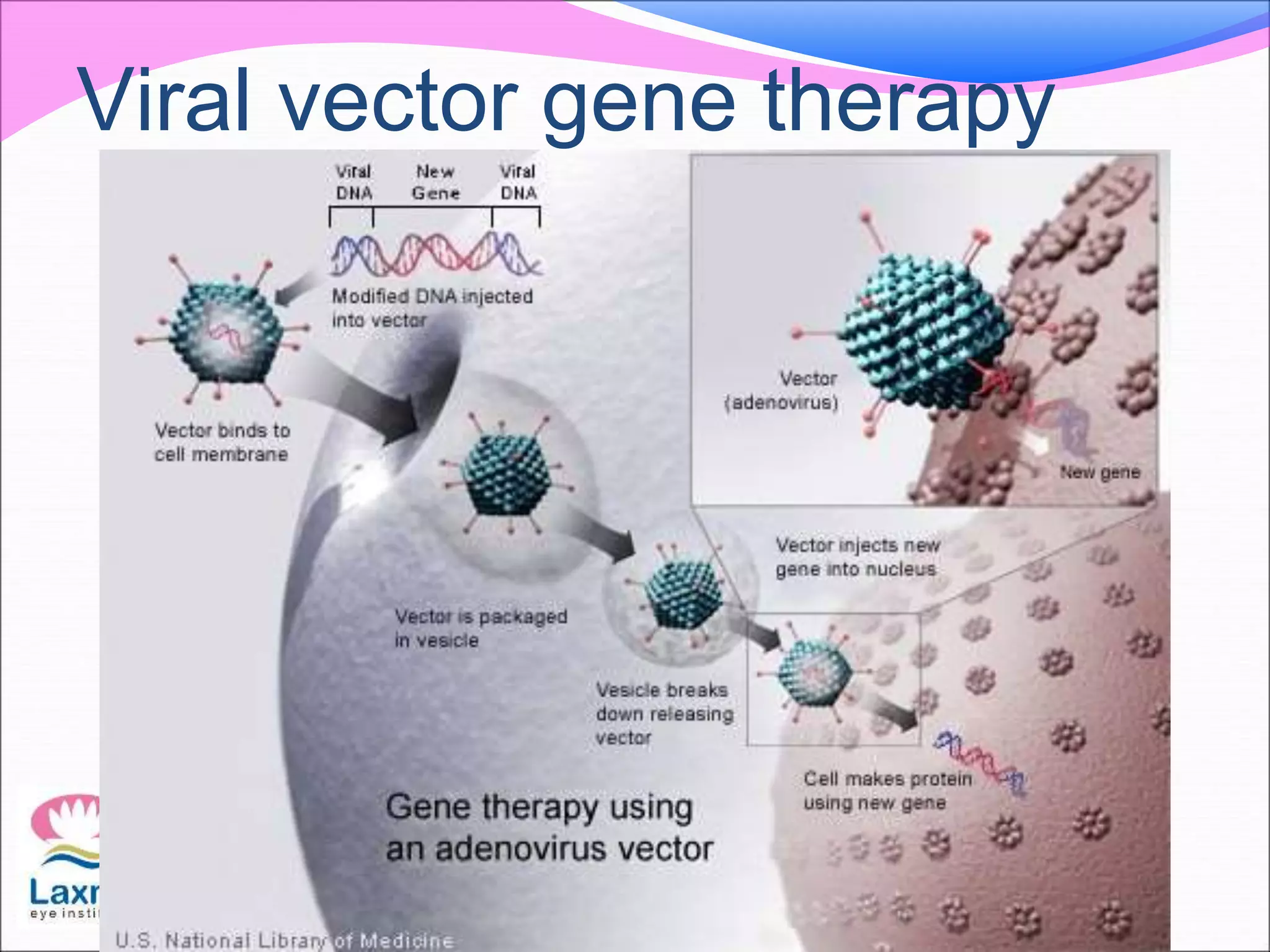 Viral vector gene therapy
 