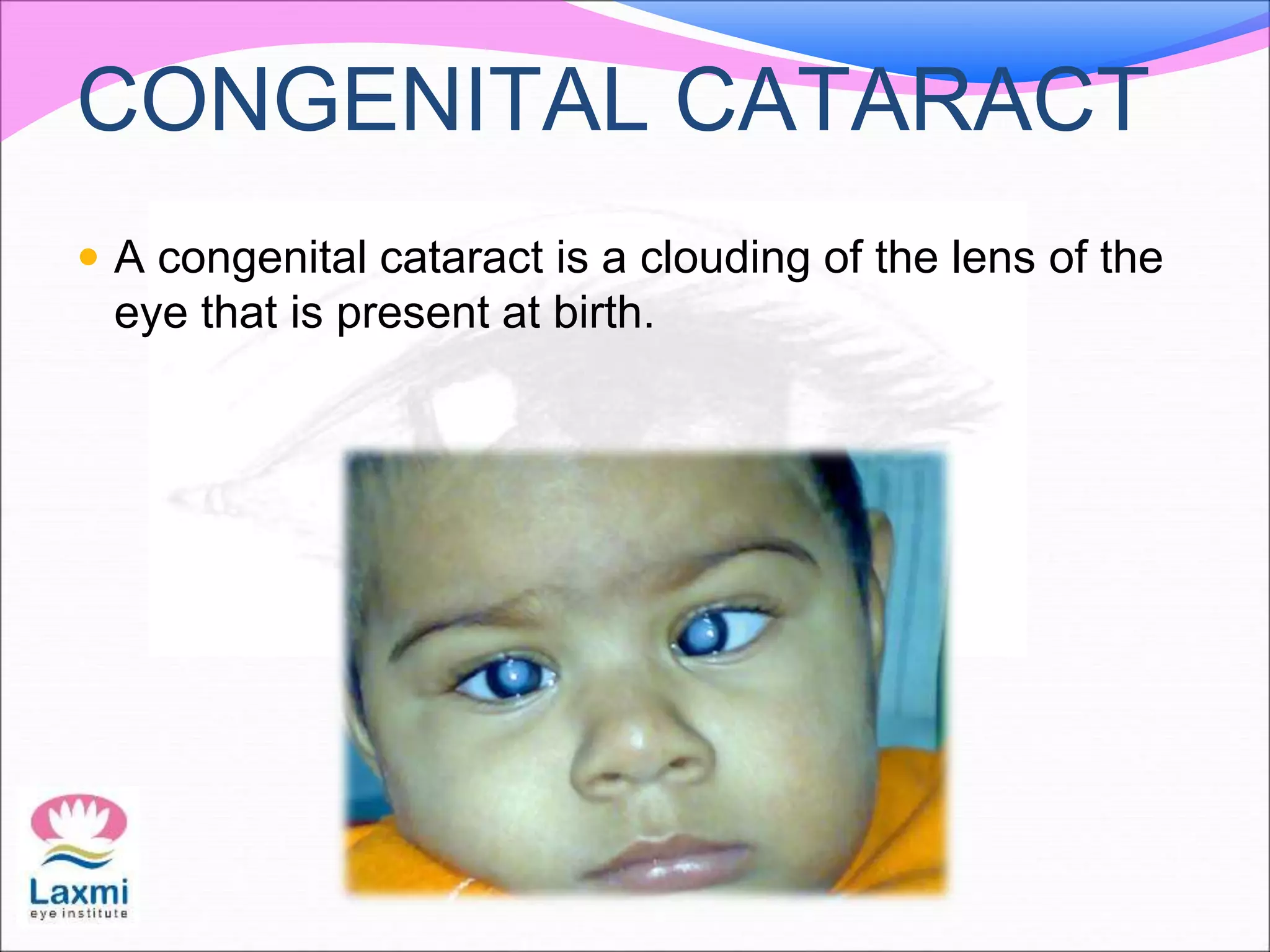 CONGENITAL CATARACT
 A congenital cataract is a clouding of the lens of the
eye that is present at birth.
 