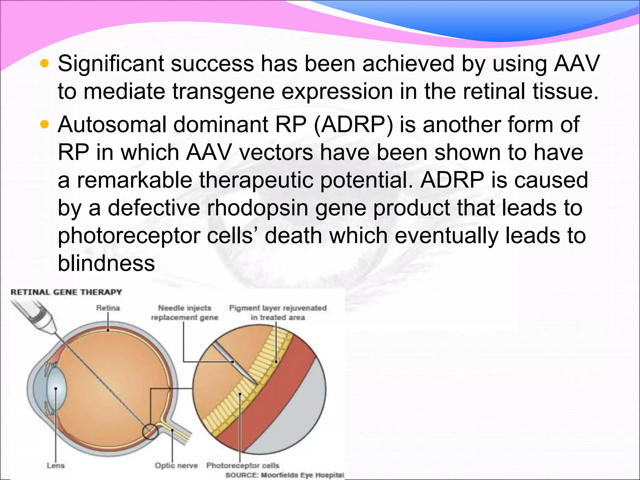  Significant success has been achieved by using AAV
to mediate transgene expression in the retinal tissue.
 Autosomal dominant RP (ADRP) is another form of
RP in which AAV vectors have been shown to have
a remarkable therapeutic potential. ADRP is caused
by a defective rhodopsin gene product that leads to
photoreceptor cells’ death which eventually leads to
blindness
 
