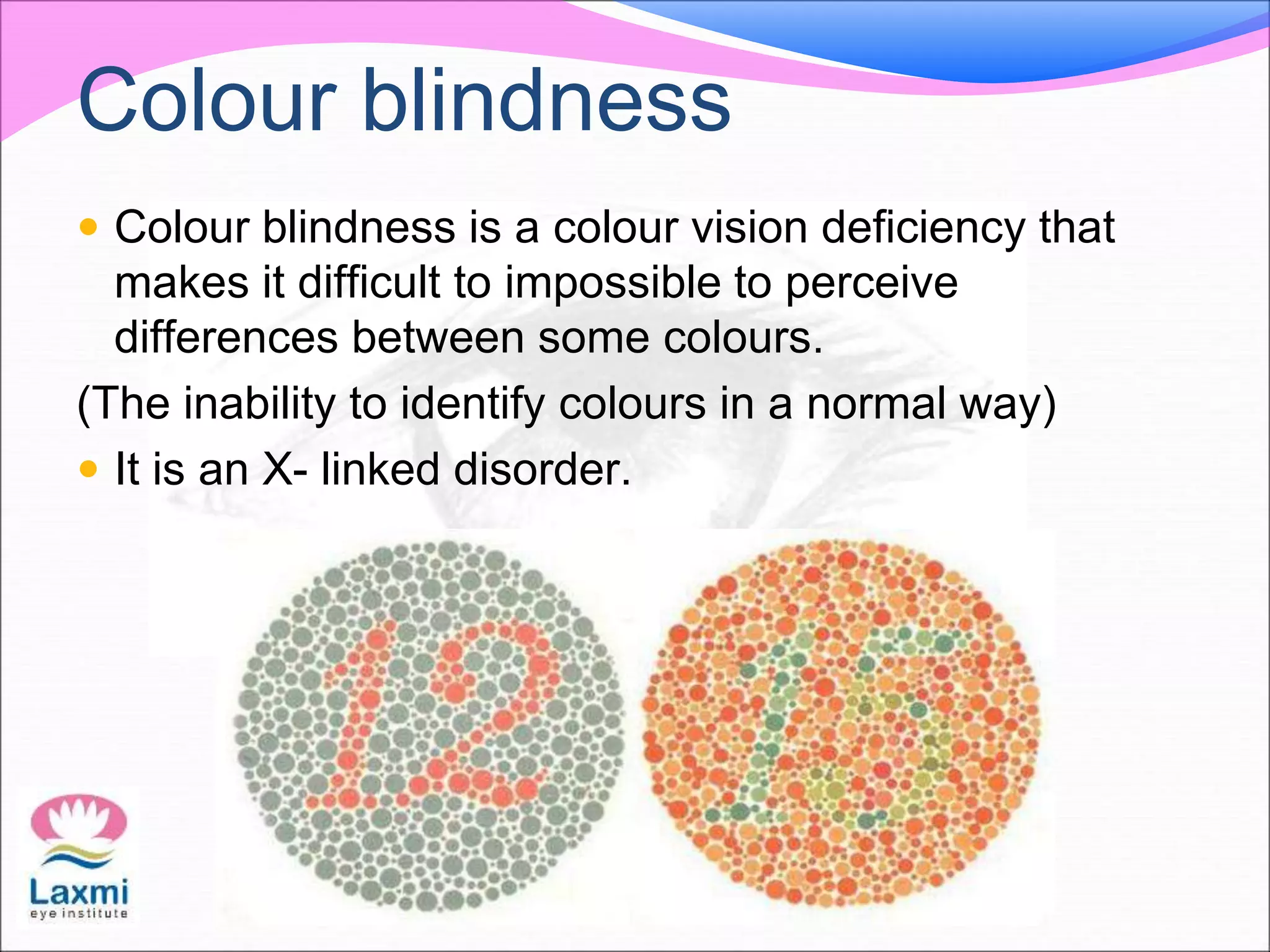 Colour blindness
 Colour blindness is a colour vision deficiency that
makes it difficult to impossible to perceive
differences between some colours.
(The inability to identify colours in a normal way)
 It is an X- linked disorder.
 