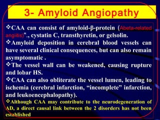3- Amyloid Angiopathy
CAA can consist of amyloid-β-protein (Abeta-related
angiitis)"., cystatin C, transthyretin, or gelsolin.
Amyloid deposition in cerebral blood vessels can
have several clinical consequences, but can also remain
asymptomatic .
The vessel wall can be weakened, causing rupture
and lobar HS.
CAA can also obliterate the vessel lumen, leading to
ischemia (cerebral infarction, “incomplete” infarction,
and leukoencephalopathy).
Although CAA may contribute to the neurodegeneration of
AD, a direct causal link between the 2 disorders has not been
established

 