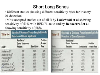 Short Long Bones
• Different studies showing different sensitivity rates for trisomy
21 detection.
• Most accepted studies out of all is by Lockwood et al showing
sensitivity of 51% with BPD/FL ratio and by Benacerraf et al
showing sensitivity of 68%.
 