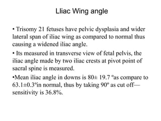 Lliac Wing angle
• Trisomy 21 fetuses have pelvic dysplasia and wider
lateral span of iliac wing as compared to normal thus
causing a widened iliac angle.
• Its measured in transverse view of fetal pelvis, the
iliac angle made by two iliac crests at pivot point of
sacral spine is measured.
•Mean iliac angle in downs is 80± 19.7 ºas compare to
63.1±0.3ºin normal, thus by taking 90º as cut off—
sensitivity is 36.8%.
 