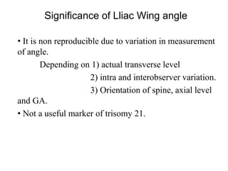 Significance of Lliac Wing angle
• It is non reproducible due to variation in measurement
of angle.
Depending on 1) actual transverse level
2) intra and interobserver variation.
3) Orientation of spine, axial level
and GA.
• Not a useful marker of trisomy 21.
 