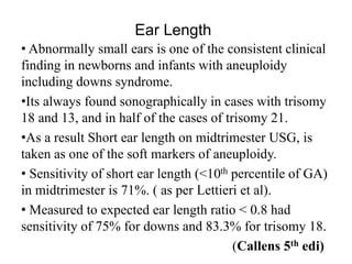 Ear Length
• Abnormally small ears is one of the consistent clinical
finding in newborns and infants with aneuploidy
including downs syndrome.
•Its always found sonographically in cases with trisomy
18 and 13, and in half of the cases of trisomy 21.
•As a result Short ear length on midtrimester USG, is
taken as one of the soft markers of aneuploidy.
• Sensitivity of short ear length (<10th percentile of GA)
in midtrimester is 71%. ( as per Lettieri et al).
• Measured to expected ear length ratio < 0.8 had
sensitivity of 75% for downs and 83.3% for trisomy 18.
(Callens 5th edi)
 