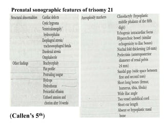 Prenatal sonographic features of trisomy 21
(Callen’s 5th)
 