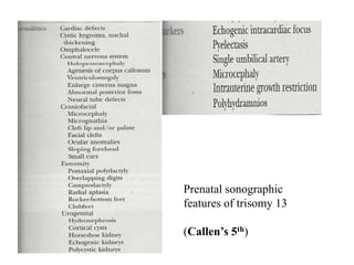 Prenatal sonographic
features of trisomy 13
(Callen’s 5th)
 