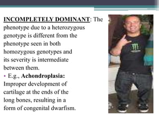INCOMPLETELY DOMINANT: The
phenotype due to a heterozygous
genotype is different from the
phenotype seen in both
homozygous genotypes and
its severity is intermediate
between them.
• E.g., Achondroplasia:
Improper development of
cartilage at the ends of the
long bones, resulting in a
form of congenital dwarfism.
 