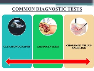 COMMON DIAGNOSTIC TESTS
ULTRASONOGRAPHY AMNIOCENTESIS
CHORIONIC VILLUS
SAMPLING
 