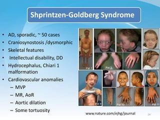 • AD, sporadic, ~ 50 cases
• Craniosynostosis /dysmorphic
• Skeletal features
• Intellectual disability, DD
• Hydrocephalu...