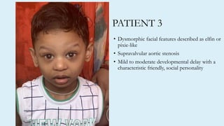PATIENT 3
• Dysmorphic facial features described as elfin or
pixie-like
• Supravalvular aortic stenosis
• Mild to moderate developmental delay with a
characteristic friendly, social personality
 