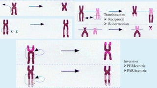 Inversion
PERIcentric
PARAcentric
Translocation
 Reciprocal
 Robertsonian
 