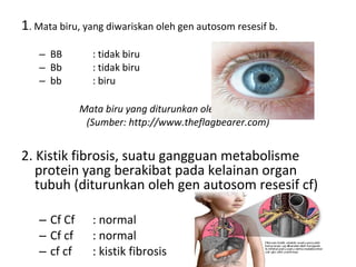 1. Mata biru, yang diwariskan oleh gen autosom resesif b.
– BB : tidak biru
– Bb : tidak biru
– bb : biru
Mata biru yang diturunkan oleh gen resesif b
(Sumber: http://www.theflagbearer.com)
2. Kistik fibrosis, suatu gangguan metabolisme
protein yang berakibat pada kelainan organ
tubuh (diturunkan oleh gen autosom resesif cf)
– Cf Cf : normal
– Cf cf : normal
– cf cf : kistik fibrosis
 