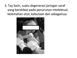 3. Tay Sach, suatu degenerasi jaringan saraf
yang berakibat pada penurunan intelektual,
kelemahan otot, kebutaan dan sebagainya.
 