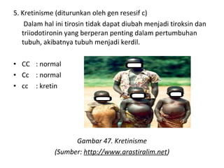 5. Kretinisme (diturunkan oleh gen resesif c)
Dalam hal ini tirosin tidak dapat diubah menjadi tiroksin dan
triiodotironin yang berperan penting dalam pertumbuhan
tubuh, akibatnya tubuh menjadi kerdil.
• CC : normal
• Cc : normal
• cc : kretin
Gambar 47. Kretinisme
(Sumber: http://www.arastiralim.net)
 