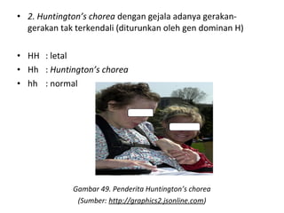 • 2. Huntington’s chorea dengan gejala adanya gerakan-
gerakan tak terkendali (diturunkan oleh gen dominan H)
• HH : letal
• Hh : Huntington’s chorea
• hh : normal
Gambar 49. Penderita Huntington’s chorea
(Sumber: http://graphics2.jsonline.com)
 