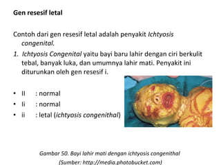 Gen resesif letal
Contoh dari gen resesif letal adalah penyakit Ichtyosis
congenital.
1. Ichtyosis Congenital yaitu bayi baru lahir dengan ciri berkulit
tebal, banyak luka, dan umumnya lahir mati. Penyakit ini
diturunkan oleh gen resesif i.
• II : normal
• Ii : normal
• ii : letal (ichtyosis congenithal)
Gambar 50. Bayi lahir mati dengan ichtyosis congenithal
(Sumber: http://media.photobucket.com)
 