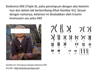 Sindroma XXX (Triple X), yaitu perempuan dengan alat kelamin
luar dan dalam tak berkembang (lihat Gambar 61). Sesuai
dengan namanya, kelainan ini disebabkan oleh trisomi
kromosom sex yaitu XXX
Gambar 61. Perempuan dengan Sindroma XXX
(Sumber: http://micahcummings.com)
 