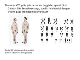 Sindroma XYY, yaitu pria bertubuh tinggi dan agresif (lihat
Gambar 59). Sesuai namanya, kondisi ini ditandai dengan
trisomi pada kromosom sex yaitu XYY
Gambar 59. Lelaki dengan Sindroma XYY
(Sumber: http://www.dkimages.com)
 