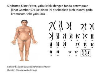 Sindroma Kline Felter, yaitu lelaki dengan tanda perempuan
(lihat Gambar 57). Kelainan ini disebabkan oleh trisomi pada
kromosom seks yaitu XXY
Gambar 57. Lelaki dengan Sindroma Kline Felter
(Sumber: http://www.butler.org)
 