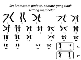 Set kromosom pada sel somatis yang tidak
sedang membelah
 